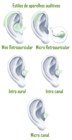 Estilos de Aparelhos Auditivos: Mini Retroauricular, Intra Canal, Micro Canal, Intra Aural e Micro Retroauricular Tipos de aparelhos auditivos